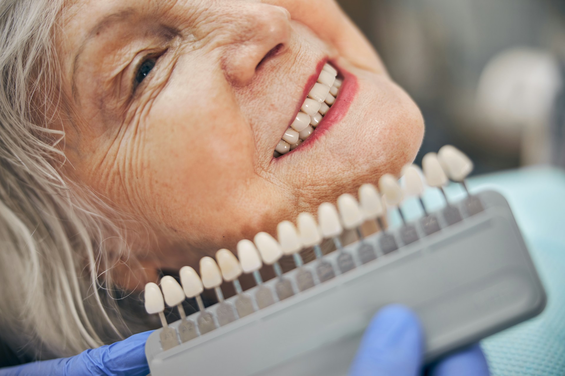 Finding Affordable Dental Implants for Seniors: Your Comprehensive Guide