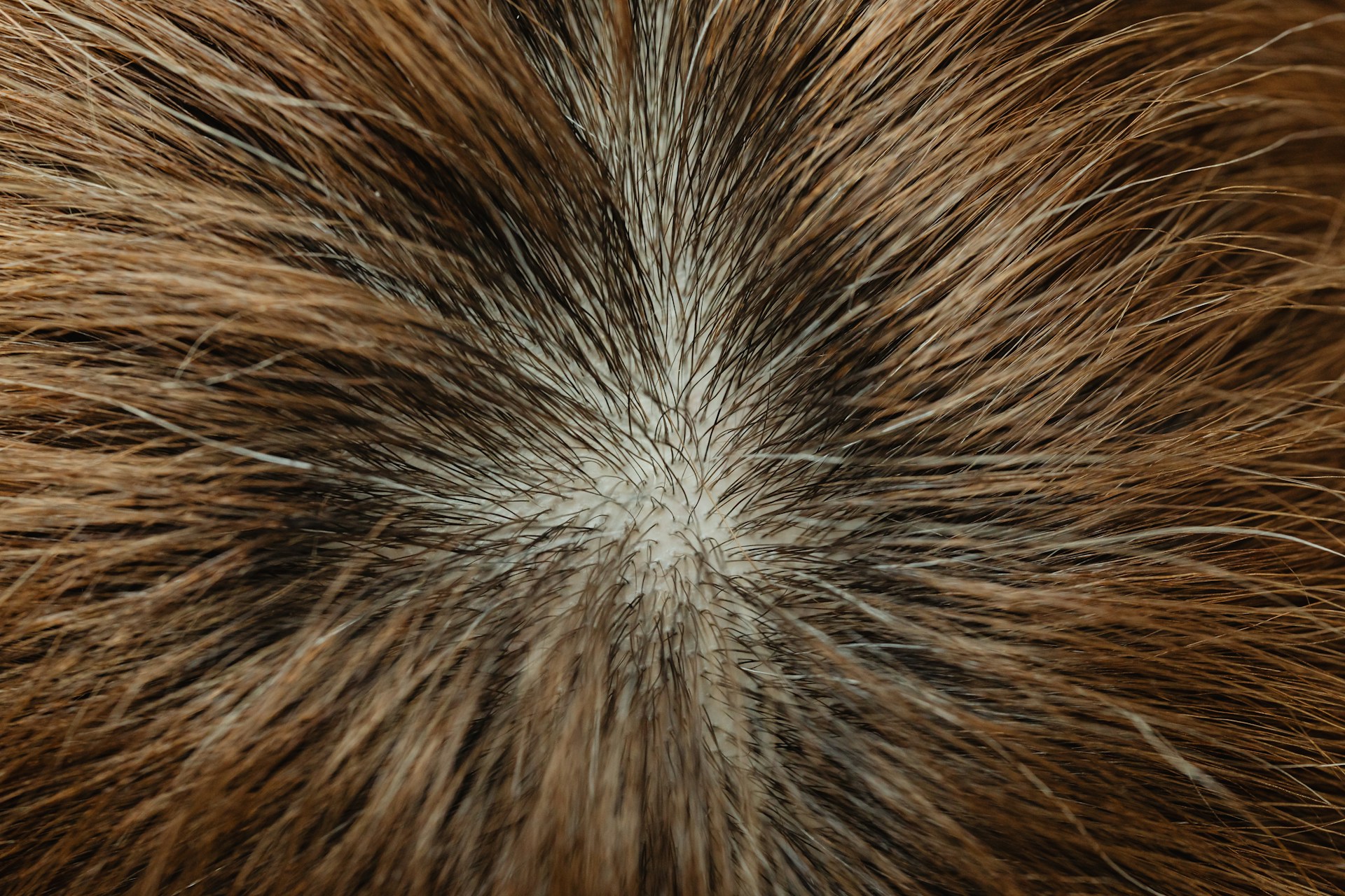 Insight into Scalp Psoriasis and Psoriatic Arthritis: Identifying Symptoms and Recognizing Visual Cues